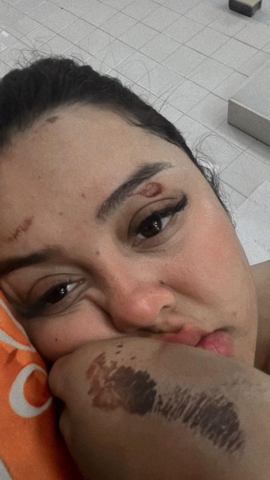 ¿Qué fue de las vendedoras de jugos atropelladas en San Pedro Sula?