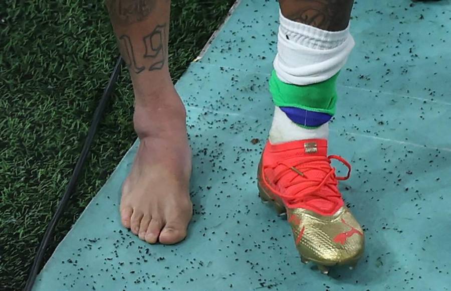 El tobillo de Neymar quedó inflamado.