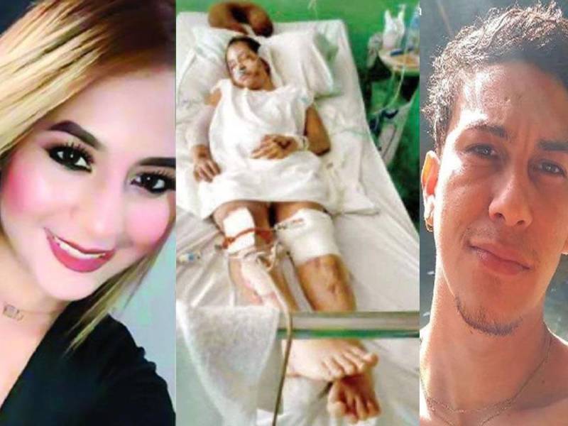 La joven sufrió heridas de gravedad.