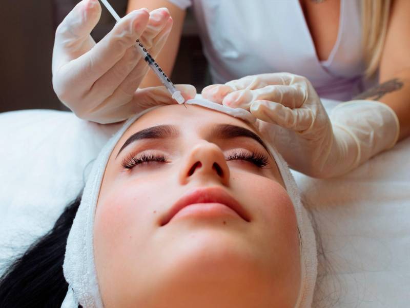 La aplicación de estos hilos se realiza en un promedio de tiempo de 30 a 60 minutos,