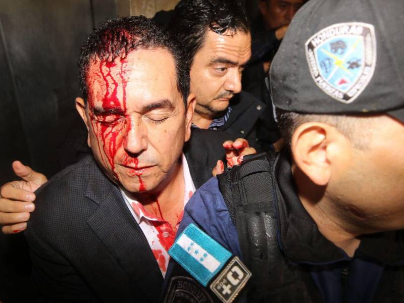 El diputado nacionalista Antonio Rivera Callejas fue agredido en la cabeza por colectivos de Libre.