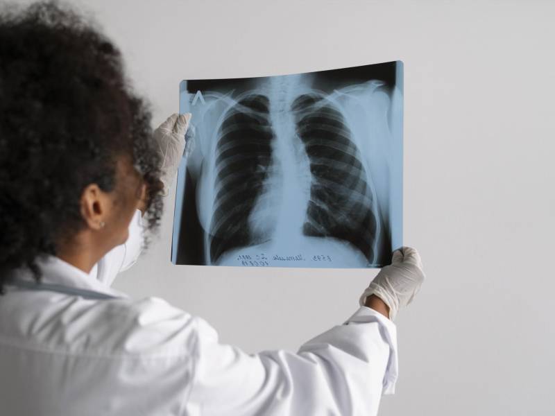 Tras cinco años de seguimiento, más de la mitad de los pacientes tratados con <b>lorlatinib </b>no vieron progresar su cáncer.