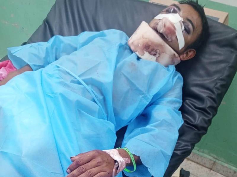 José Eliseo López Escobar en el hospital Mario Catarino Rivas, de donde se escapó.