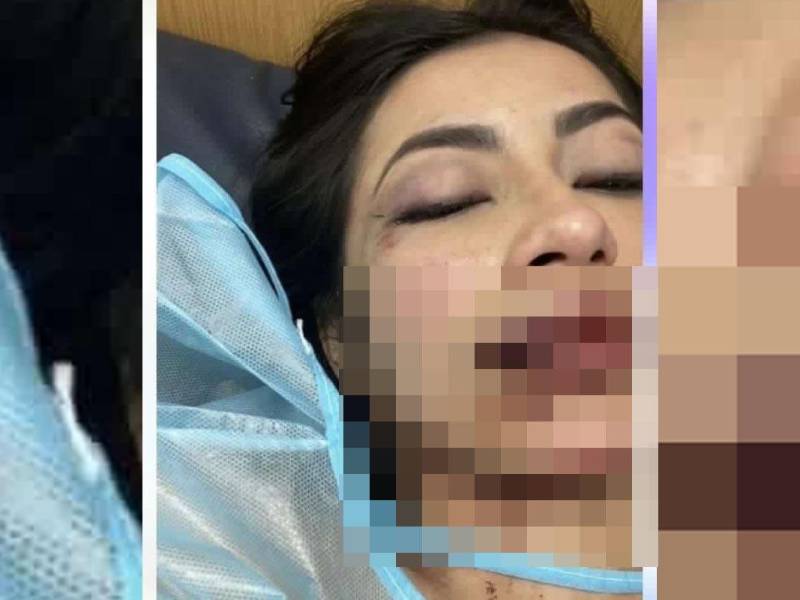 La colombiana Daniela Aldana fue supuestamente agredida por su novio Isaac Sandoval, lo que ha causado indignación en las redes sociales.