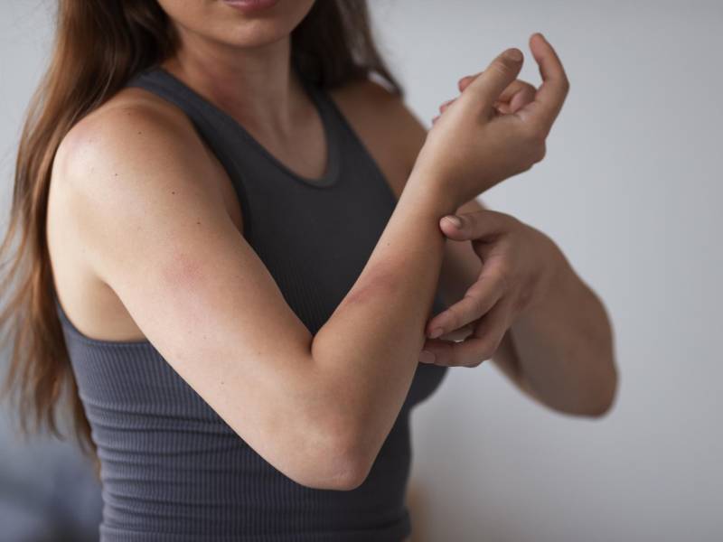 Esta enfermedad se transmite a los humanos por ciertos insectos.