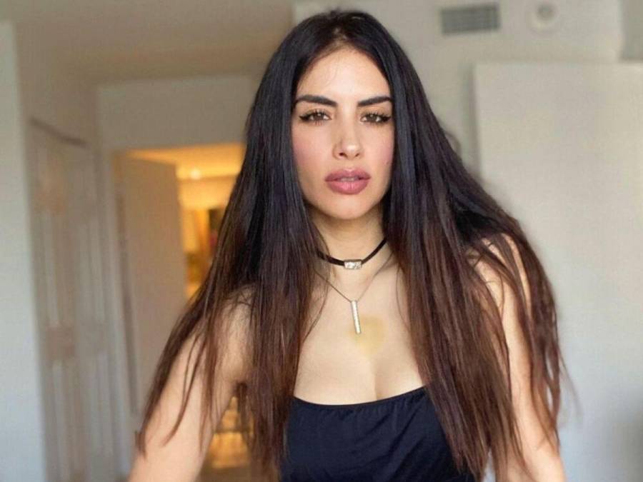 La presentadora y modelo colombiana Jessica Cediel. Martín Carrillo fue la persona que hace varios años le inyectó plástico en la cola a la bogotana. En 2016, ella habló de su experiencia y contó que a causa de ese procedimiento tuvo que someterse a tres cirugías para intentar remover la mayor cantidad de biopolímeros que tenía en su cuerpo.