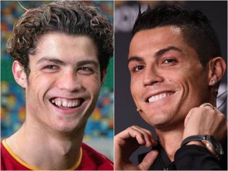 El antes y el después de Cristiano Ronaldo es abismal.