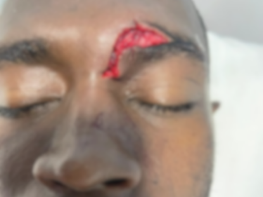 Imágenes fuertes: Las heridas de los jugadores del Independiente