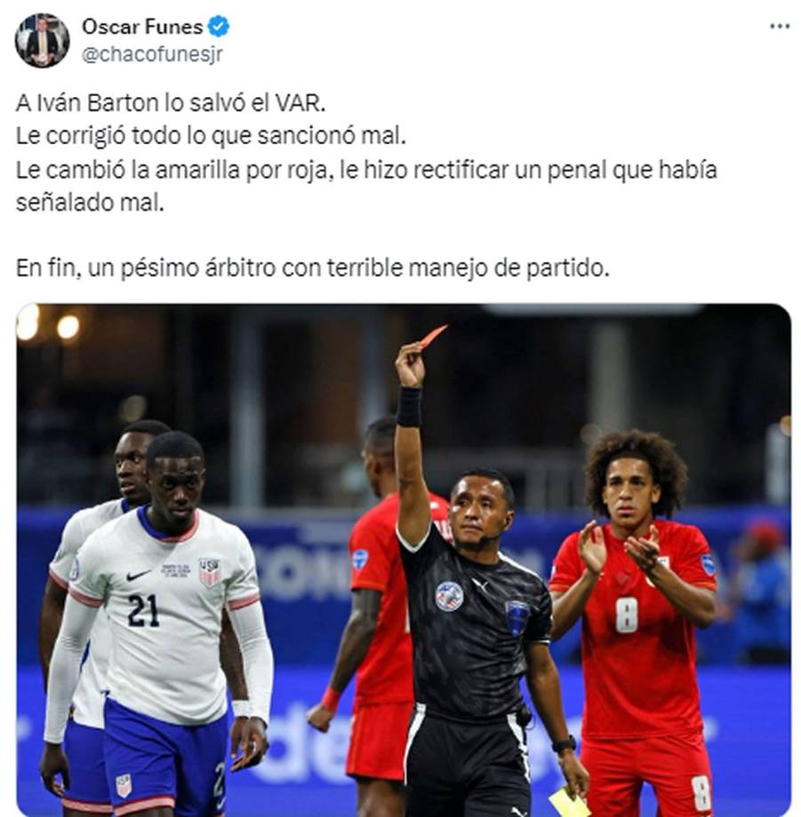Óscar Funes, periodista de Tigo Sports Honduras, escribió que Iván Barton “un pésimo árbitro con terrible manejo de partido”.