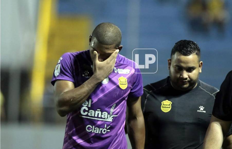 El portero del Real España se fue muy sentido del campo tras lesionarse.