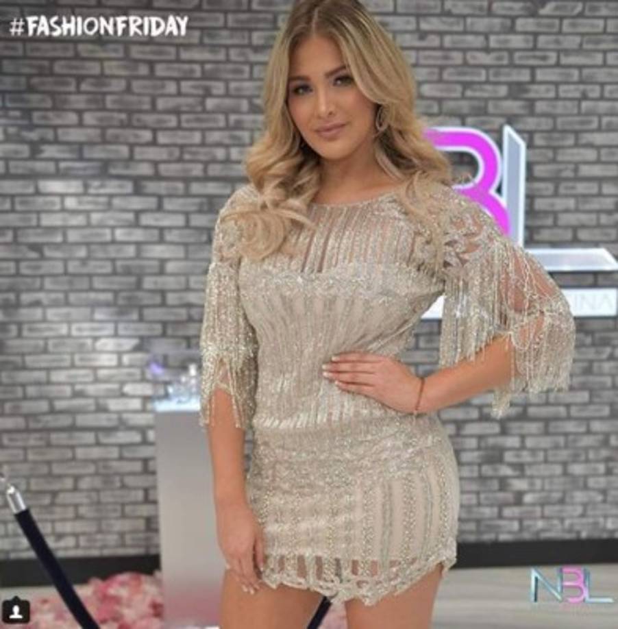 Migbelis Castellanos es una de las chicas con la Owen compite en la final de NBL 2018. Castellanos fue miss Venezuela en 2013. Sin embargo; no pudo destacar en la 63 edición de Miss Universo. Lo que puso muy molesto a Osmel Sousa, presidente de la Organización Miss Venezuela.