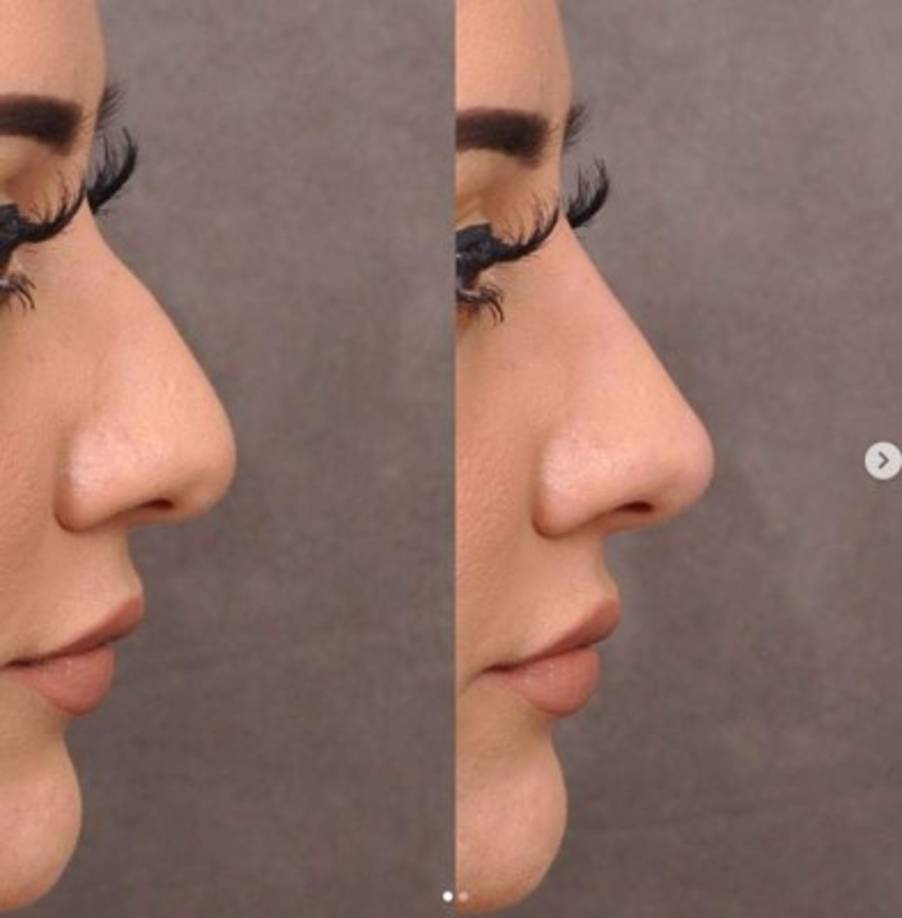 Esta imagen muestra el antes y después de una cirugía que practicó.