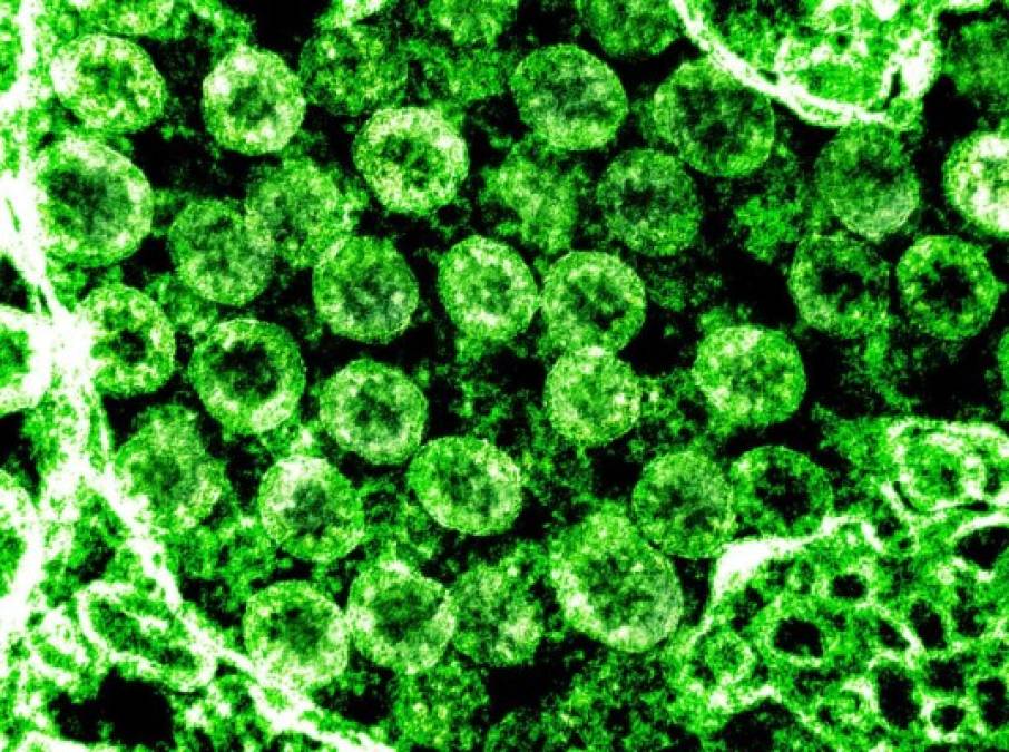 Publican fotos reales del coronavirus: así se ven las células infectadas por COVID-19