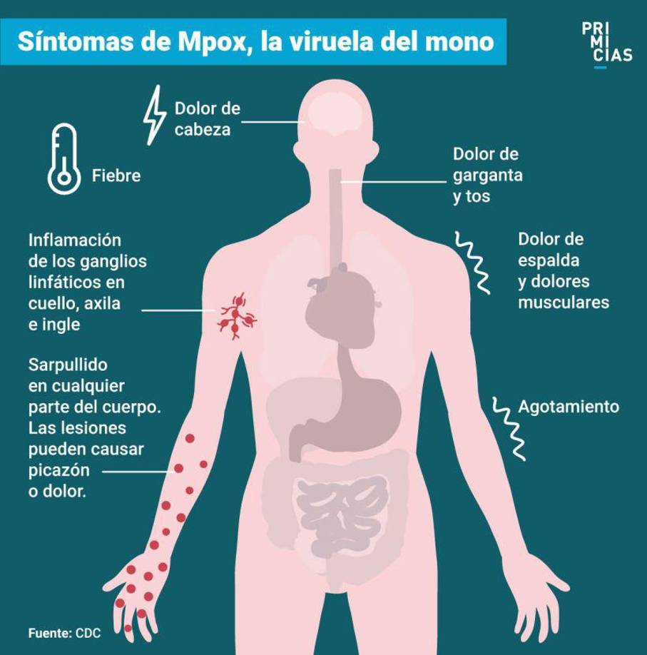 Los síntomas generalmente aparecen entre 5 y 21 días después de la exposición al virus. Los primeros signos incluyen: fiebre, escalofríos, dolor de cabeza, fatiga y dolores musculares. 