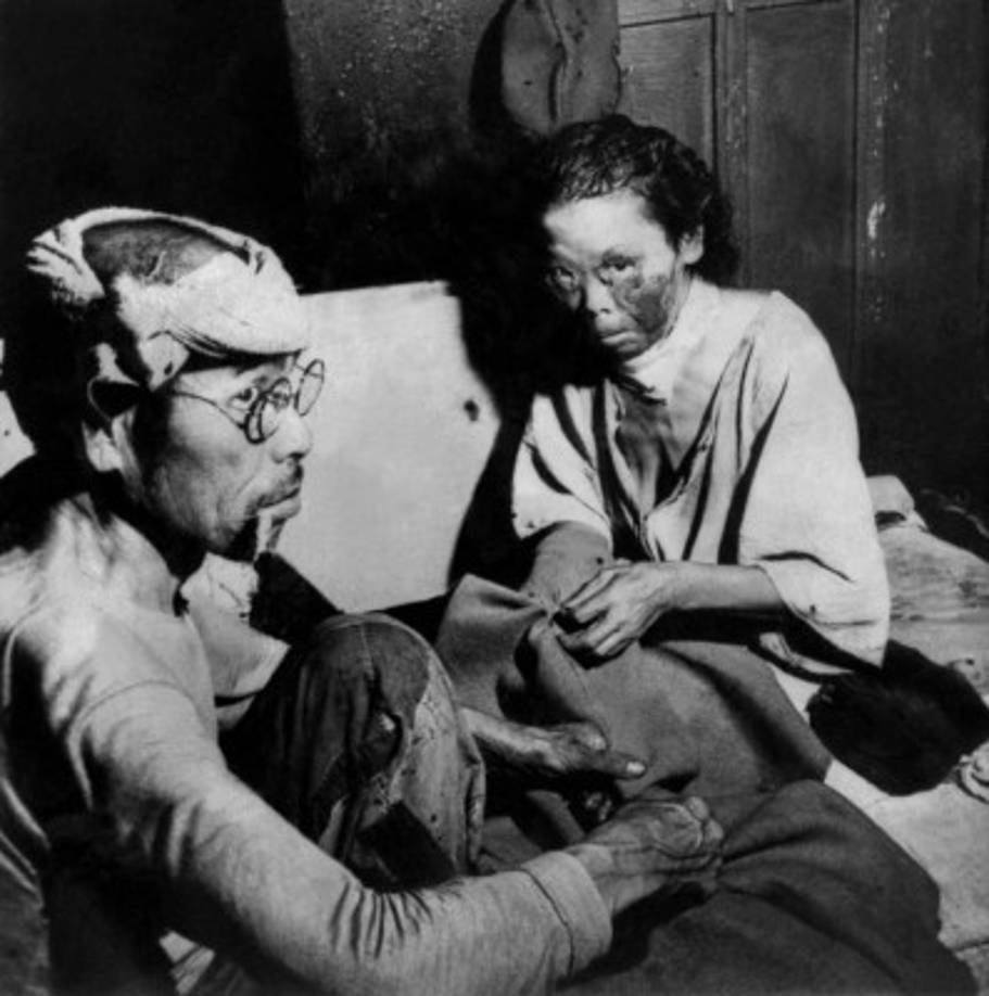 Los efectos sobre la salud de la radiación se dividen en dos categorías: problemas agudos que se produjeron hasta fines de 1945, y otros que se desarrollaron más adelante.