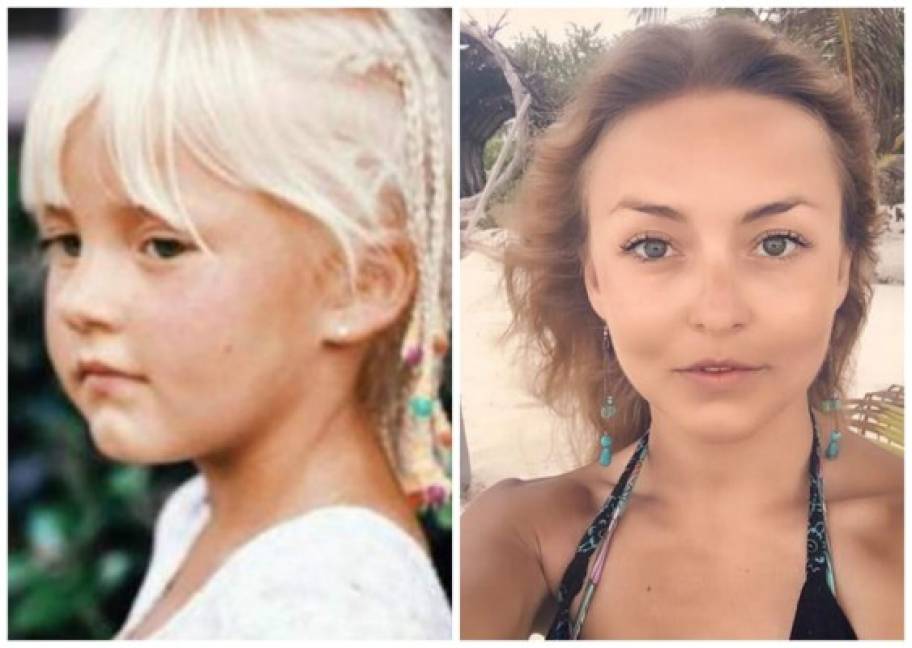Atriz Angelique Boyer nasceu com o lábio leporino