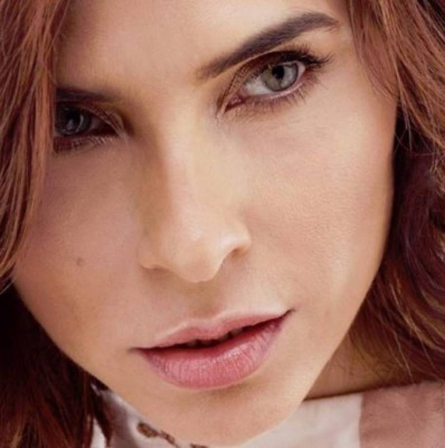 La intérprete demuestra que se siente orgullosa, y que una enfermedad no debe generar complejos, al contrario, se debe valorar la lucha de la persona por estar cada día mejor.