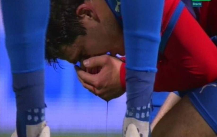 Milan Havel sangró mucho de la nariz tras el codazo de Sergio Ramos. El jugador no pudo seguir en el partido y salió de cambio. Foto Twitter