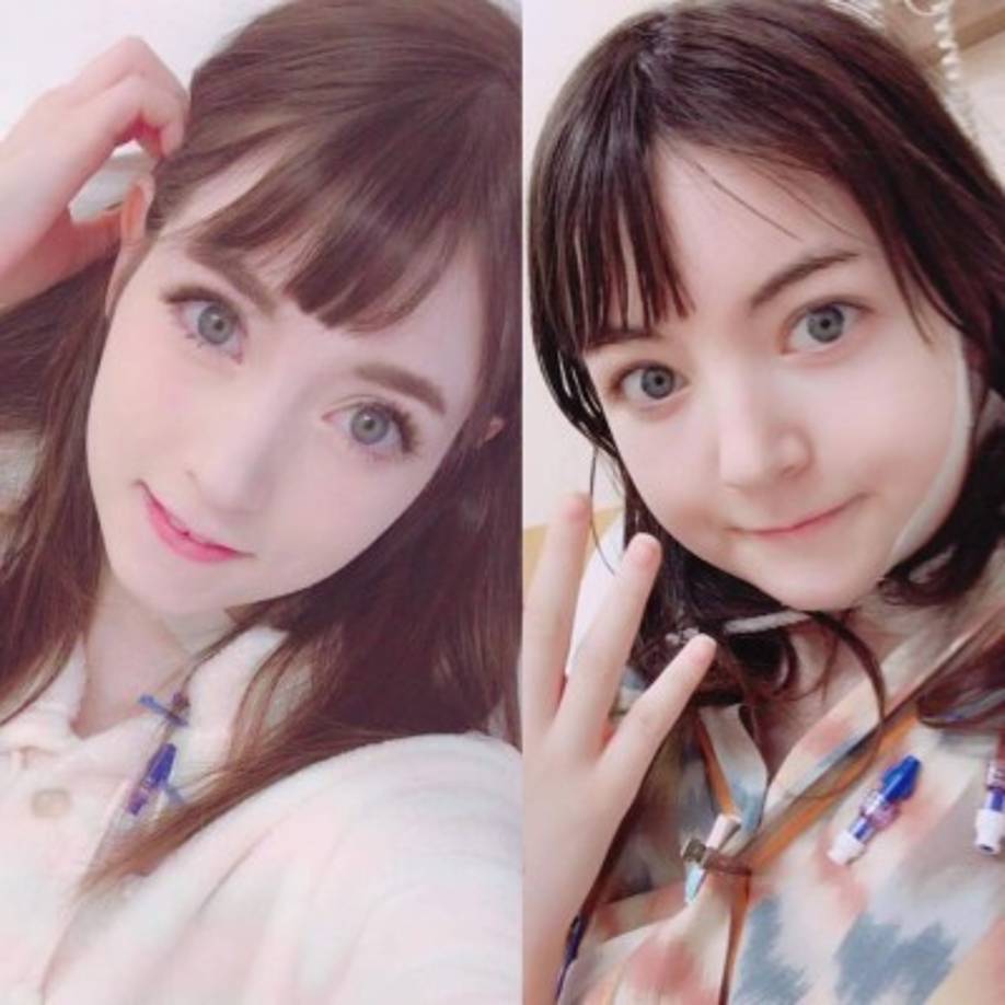 Cuando los dolores se volvieron insoportables, la influencer decidió ir a un hospital, en donde le informaron que las suturas estaban en mal estado y que la comida que ingería no estaba siendo procesada.