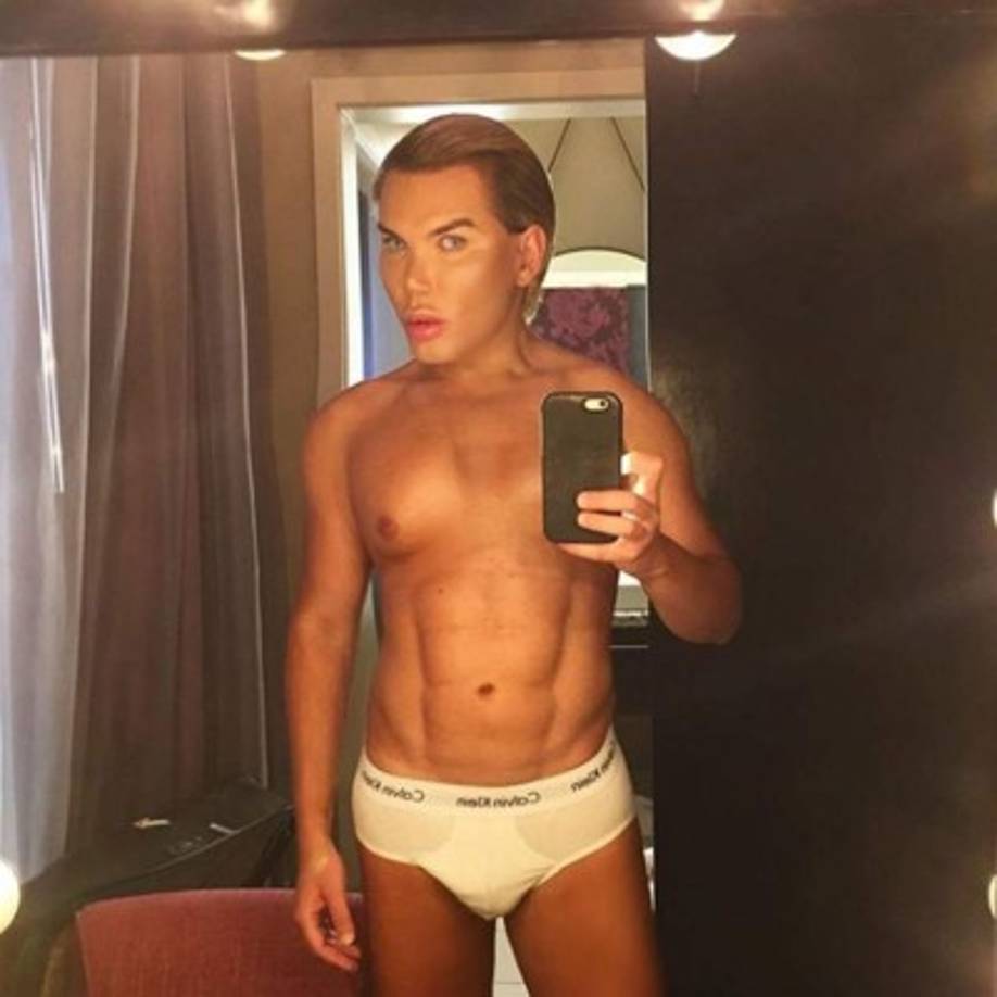 Así luce Rodrigo Alves al desnudo, luego de haber invertido 80,000 dólares en procedimientos cosméticos.<br/>