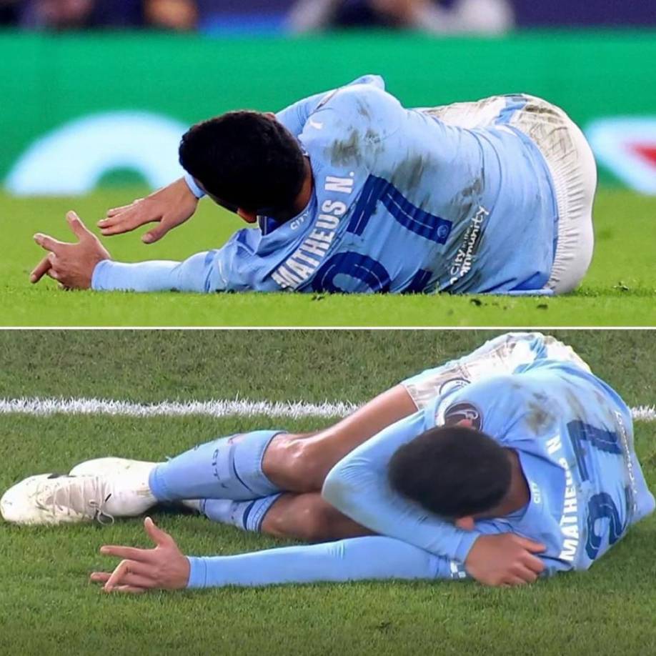 El centrocampista portugués del Manchester City, Matheus Nunes, sufrió esta escalofriante lesión en un dedo de su mano izquierda.