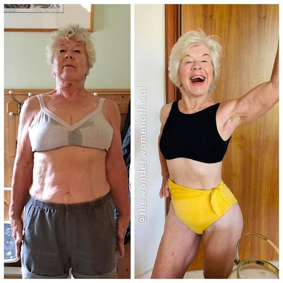 Joan se vio sumida en una profunda depresión tras separarse de su esposo, luego de haber sido pareja por varias décadas. Su estado de ánimo le hizo ganar mucho peso, lo que también comenzó a mermar su salud.