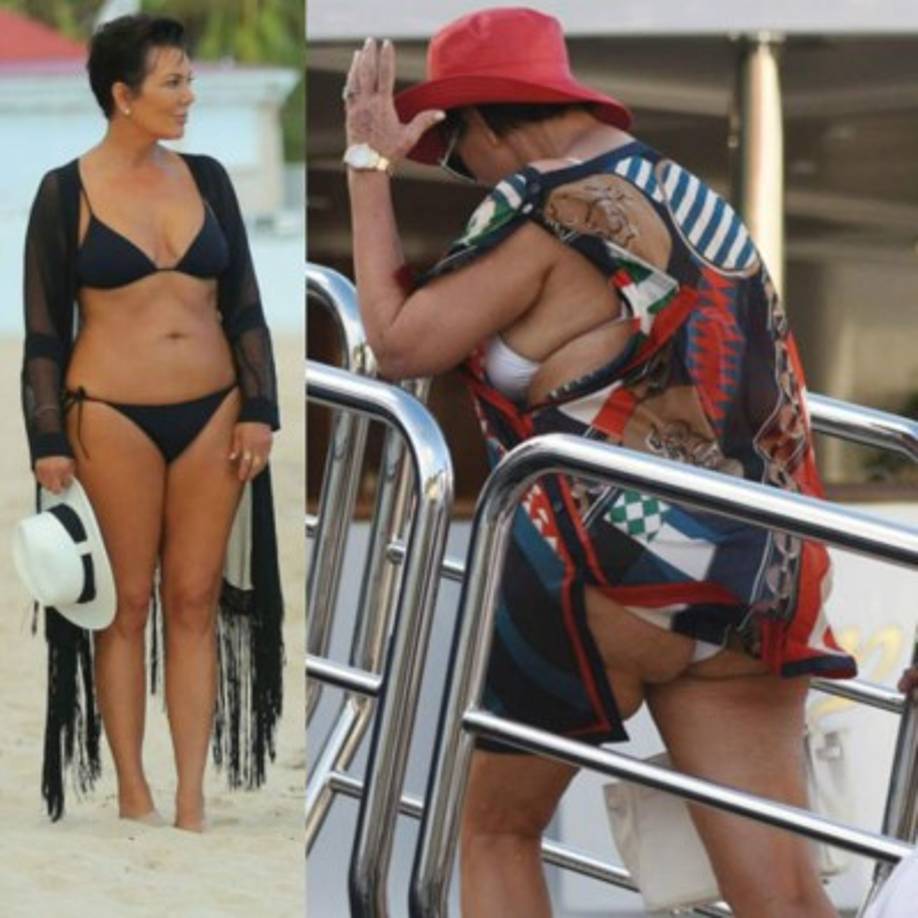 En la primera foto Kirs Jenner en agosto de 2015 y en la otra en el pasado fin de año en St. Barts. Fotos:Radar Online<br/>