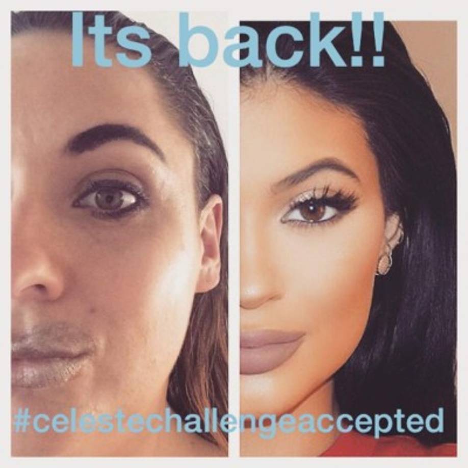 Tampoco podía dejar de imitar a Kylie Jenner.