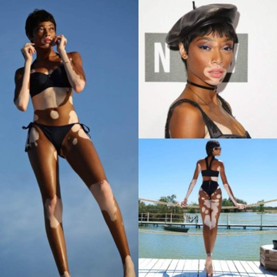 Canadian model Winnie Harlow poses on the red carpet upon arrival at The Fashion Awards 2019 in London on December 2, 2019. - The Fashion Awards are an annual celebration of creativity and innovation will shine a spotlight on exceptional individuals and influential businesses that have made significant contributions to the global fashion industry over the past twelve months. (Photo by Isabel Infantes / AFP) / RESTRICTED TO EDITORIAL USE - NO MARKETING NO ADVERTISING CAMPAIGNS