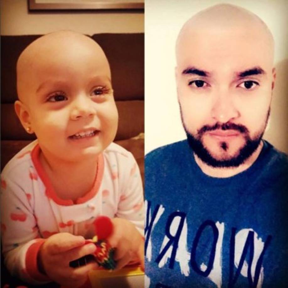 La niña ha perdido su cabello por los fuertes tratamientos para contrarrestar el cáncer en la sangre que lastimosamente padece, y Kenneth también se ha rapado como una muestra de solidaridad con su hija.<br/><br/>'La solidaridad hace los retos de la vida más fácil, lo que para unos es sencillo para otros lo es todo, en apoyo a mi princesa y en honor a los angelitos que se nos adelantaron. Gracias Dios por tu infinita misericordia', expresó.