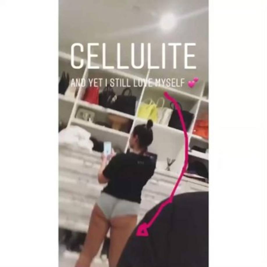 Hace escasos días, la que fuera niña Disney fue un paso más allá compartiendo con los internautas una serie de instantáneas en las que se apreciaban claramente sus estrías y otras marcas de la piel que antes ocultaba con cierto bochorno.