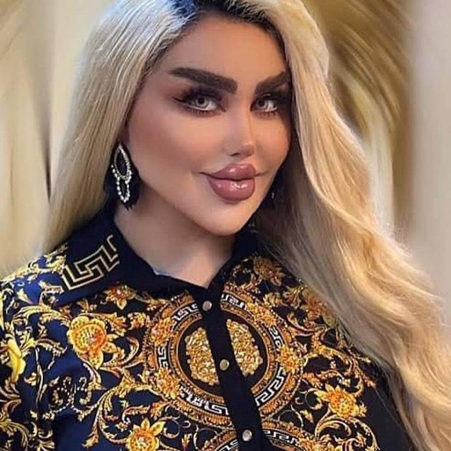 A pesar de las críticas, Dalia las ignora y continúa subiendo contenido a Instagram y TikTok donde posa segura de sí misma dando a entender que a ella le encantan sus cambios que la hacen igual de hermosa que una Barbie.