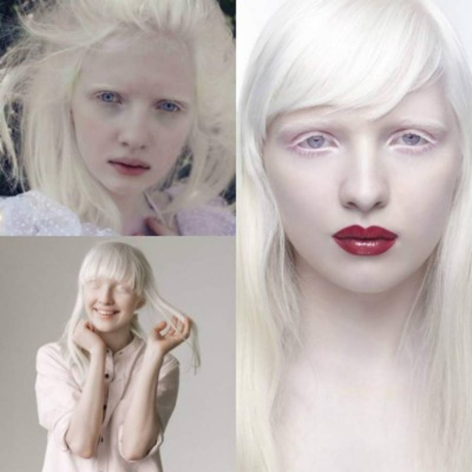 Nastya Zhidkova: antes de ser modelo fue cosplay en su natal Moscú. Disfrutaba de disfrazarse de personajes de animé japoneses. Sin embargo, su singular belleza no pasaría desapercibida.<br/><br/>Pronto, la rusa llamaría la atención de las publicaciones de moda más prestigiosas. Su condición de albina le brinda un aspecto por más delicado. Combina sus ojos azules con un pelo blanco y piel a tono. Zhidkova se adentró de inmediato en la lista selecta de los diseñadores de alta costura.