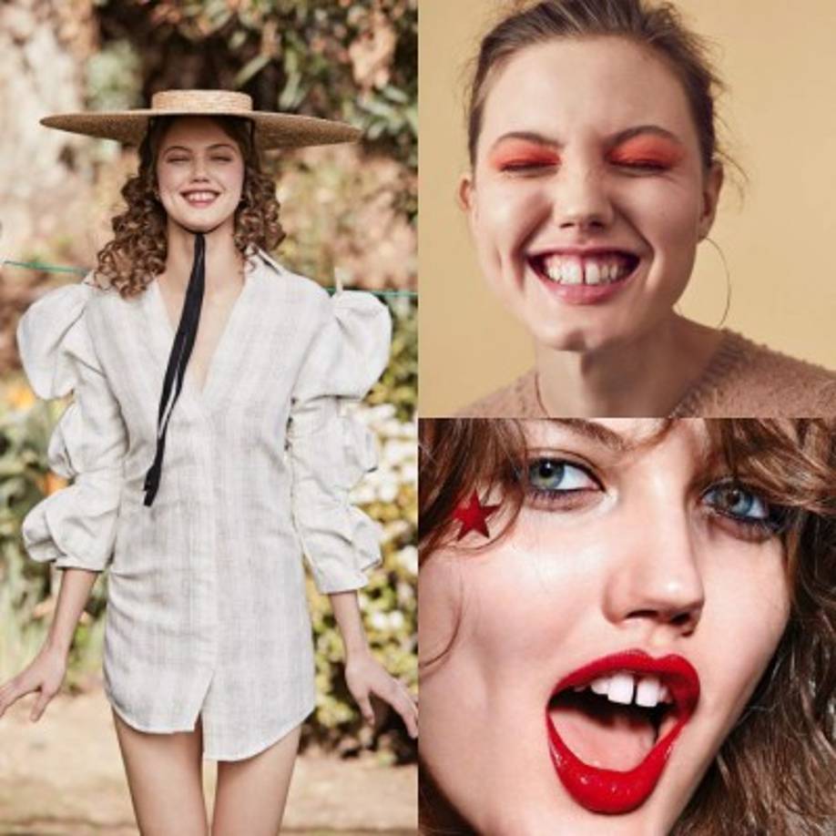 Lindsey Wixson: sus dientes separados y desproporcionados, bien podrían ser vistos como defectos. No obstante, la moda busca renovación, de caras nuevas y belleza exótica. Por eso, Wixon, de 23 años, nacida en Kansas, ya posó para la portada de Vogue Italia y fue contratada para para desfiles de Prada.<br/><br/>Al igual que en los casos anteriores, Wixson fue víctima de bullying en el colegio. Le decían que sus dientes bien podría ser un 'estacionamiento'. A los 12 le dijeron que su singular belleza la podía transformar en modelo. Lo dudó hasta que se topó con un artículo en Reader's Digest sobre Bill Gates y otros millonarios en el que remarcaban el valor de aprovechar las oportunidades. <br/><br/>Junto a su familia, aceptó el reto. Sus padres, de condición humilde, pidieron un préstamo para conducir desde Kansas hasta Los Ángeles. Allí, la joven comenzó una prolífica carrera que sigue creciendo.<br/>