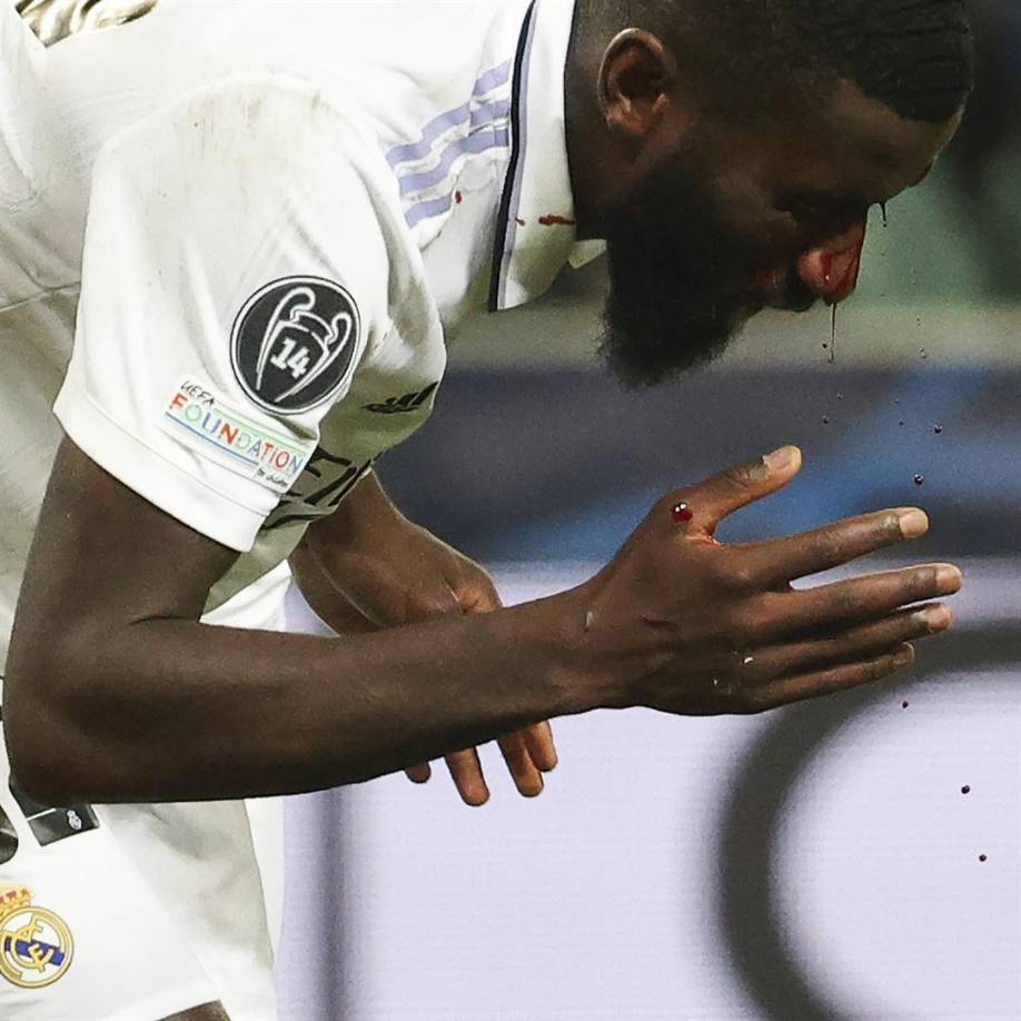 Antonio Rüdiger sangró bastante de su rostro tras el escalofriante golpe.