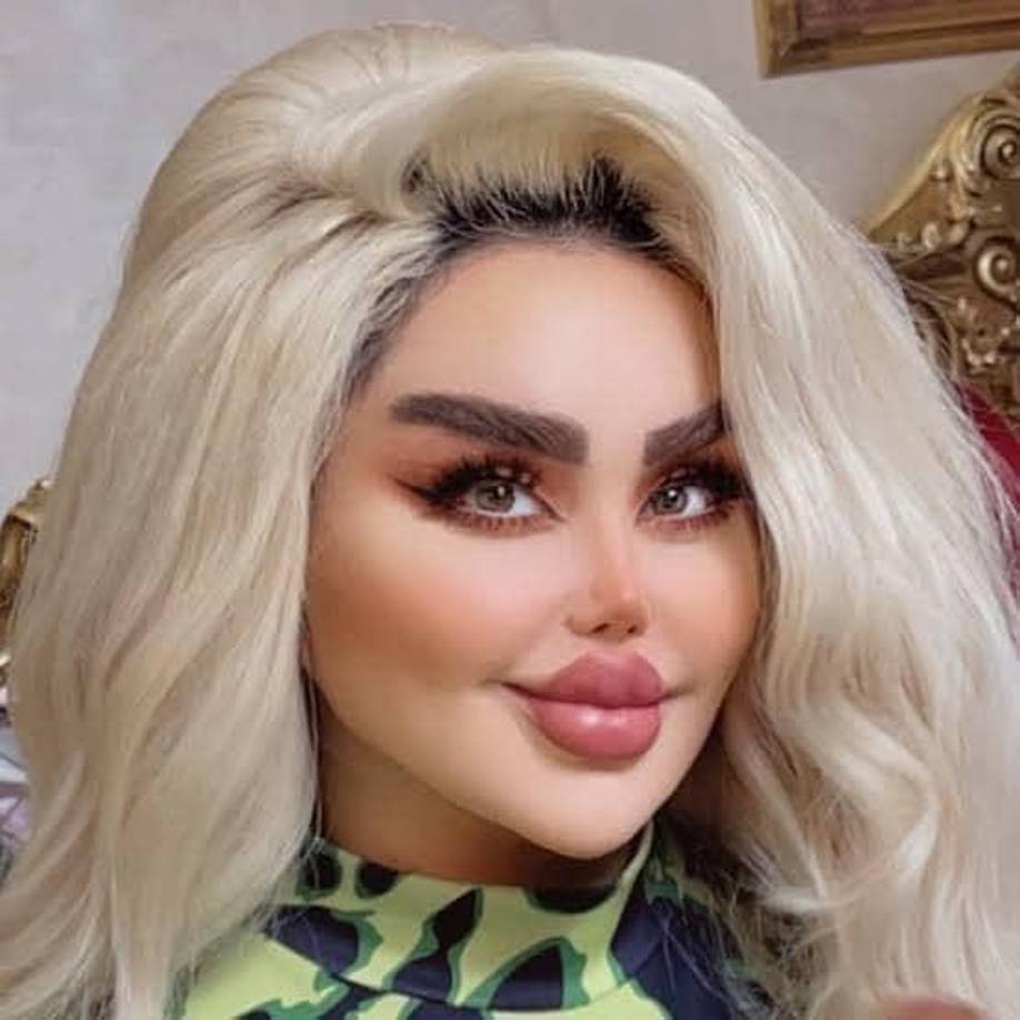 La famosa presentadora no ha dado entrevistas, compartido cuánto dinero ha gastado en todas las cirugías o dado una explicación sobre el origen de su deseo por ser igual a la popular muñeca.