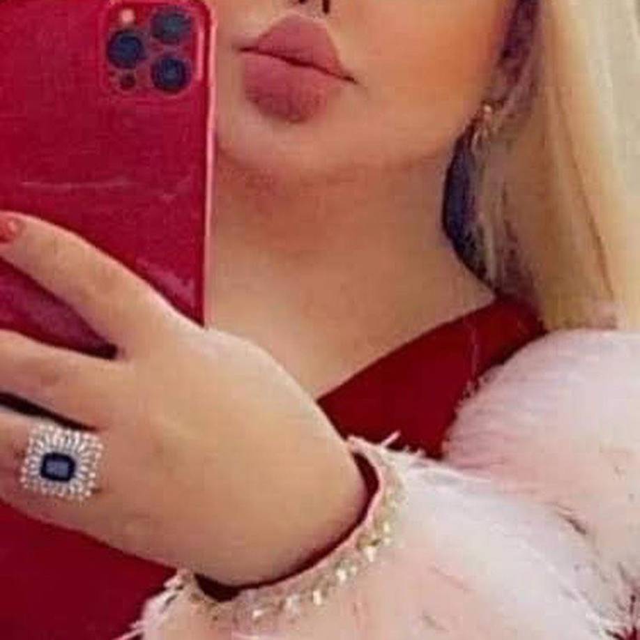 Otros piensan que llevó demasiado lejos sus cirugías, ya que anteriormente lucía natural y ahora, el exceso de procedimientos y filtros “destrozaron” su cara.