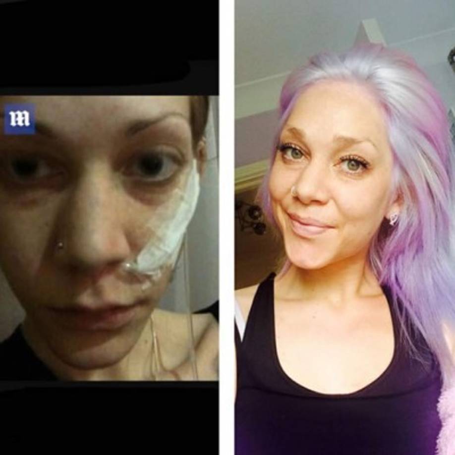 La chica inglesa, incluso, sufrió un accidente y así luce ahora.