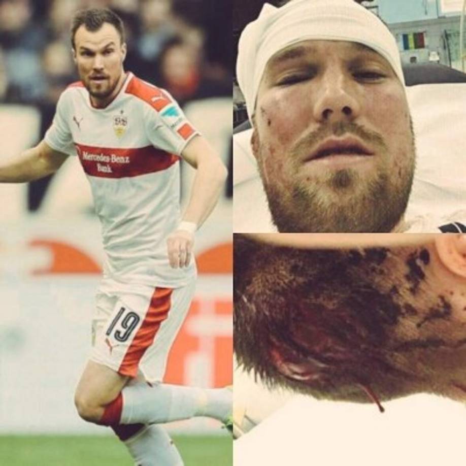 Polémica: El jugador alemán Kevin Grosskreutz ha sido despedido del Stuttgart por motivos extradeportivos. Protagonizó una lamentable pelea que acabó con el futbolista en el hospital. Ahora, el conjunto alemán propietario de sus derechos ha decidido rescindirle el contrato.