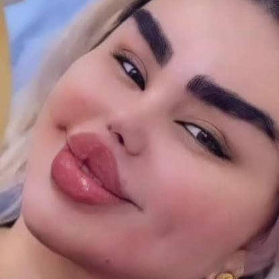 En una de sus últimas selfies de Instagram, Dalia mostró el resultado de su última cirugía.