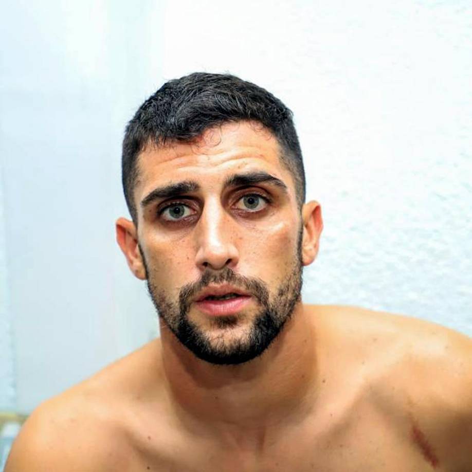 El delantero argentino del Marathón, Lucas Campana, mostró como le quedó su pómulo izquierdo tras el zafarrancho.