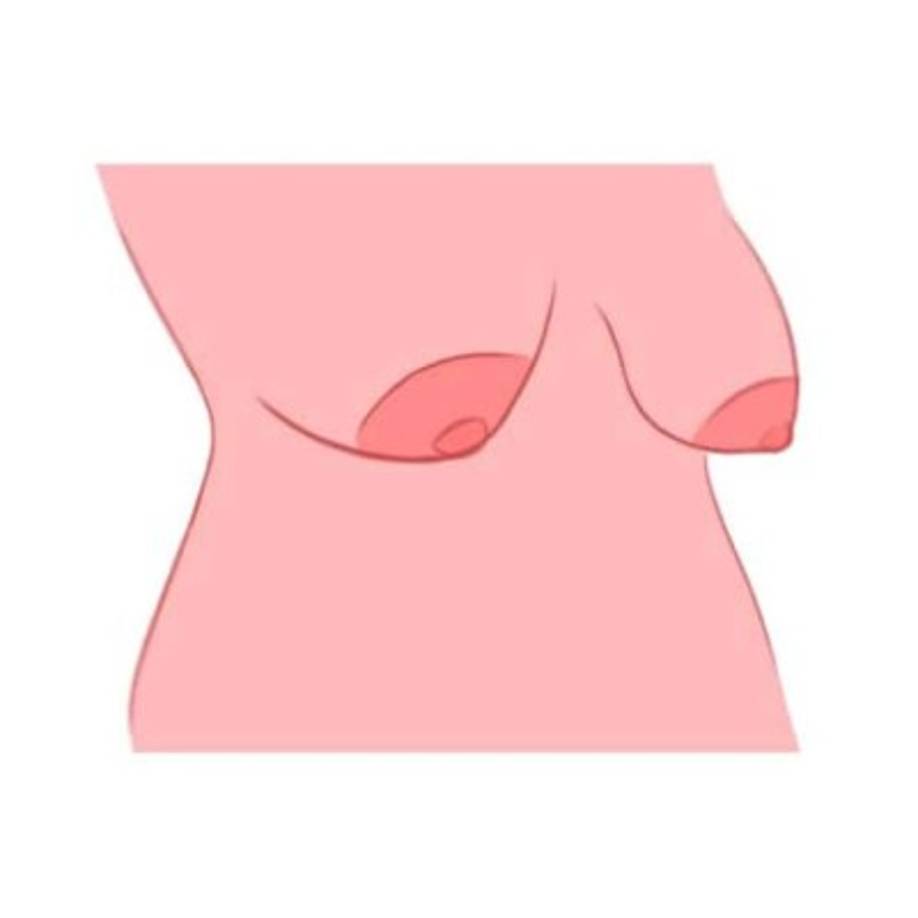 4. Forma de pera (Con pezones grandes, triangulares y orientados hacia abajo)<br/><br/>La sensualidad y la independencia feroz, dos cualidades que van extremadamente bien juntas, son lo que posees en abundancia. Pero eso no es todo, ya que tu fuerte personalidad se combina con una sensación de optimismo que es contagioso. Lo que te hace tan sensual es tu comprensión de ti misma, una cualidad poco común.