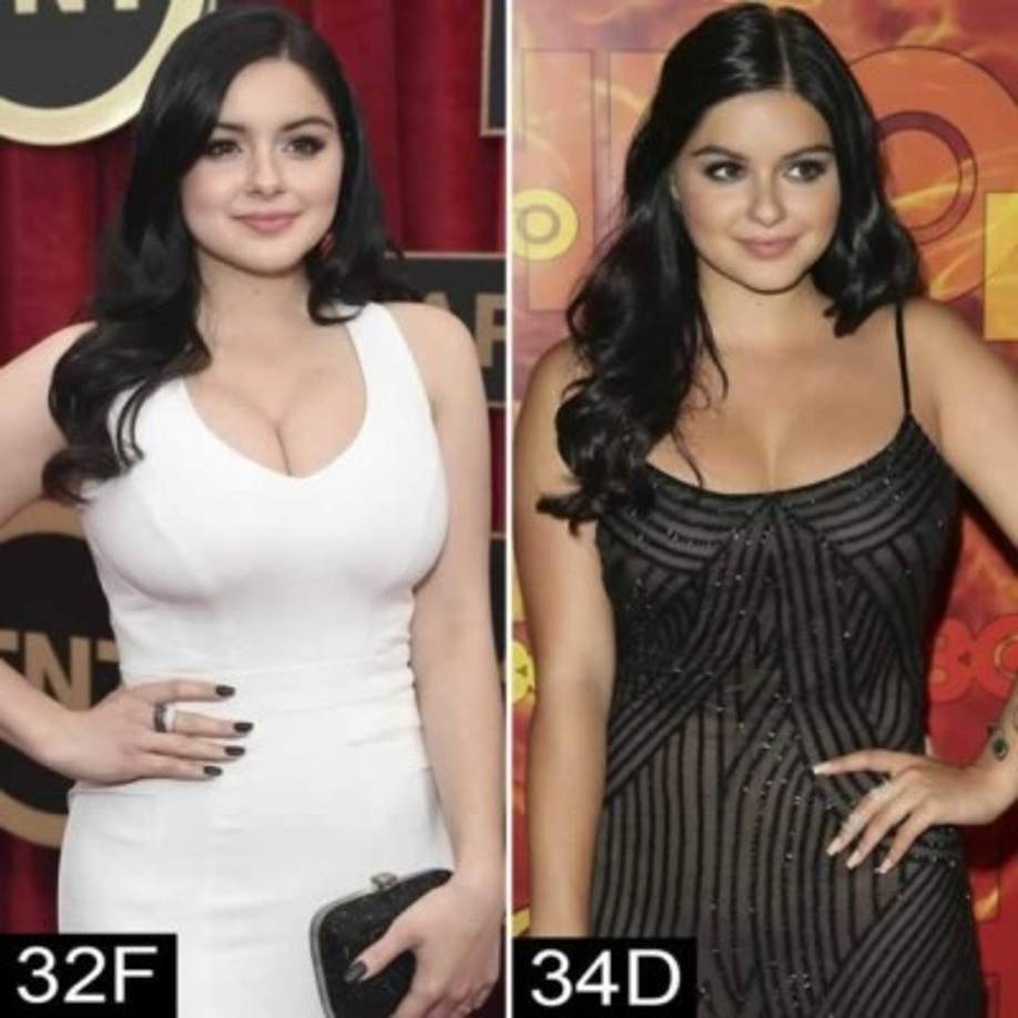 La estrella de Modern Family Ariel Winter, se sometió a una mamoplastia de reducción de senos en 2015, debido a que su busto le producía dolor de espalda y le impedía estar erguida durante un periodo de tiempo prolongado. <a href='https://www.laprensa.hn/inicio/1095376-411/famosas-senos-grandes-atributo-problema-discriminacion' style='color:red;text-decoration:underline' target='_blank'>MIRA: Famosas con senos grandes ¿Atributo o problema? </a>