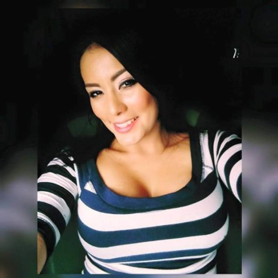 Elsa Oseguera tiene una operacion de senos.