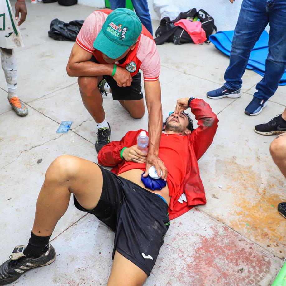 El presidente del Marathón, Flavio Chagas, con gestos de mucho dolor por el duro golpe que le dio el presunto familiar del presidente del Olancho FC, Samuel García.