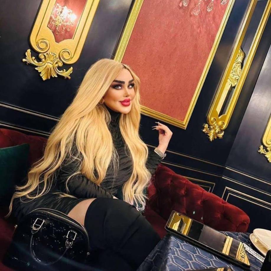 “No necesitaba tantas cirugías para parecerse a Barbie, muy mal que ya no sepa parar”, “Para destrozarle la cara tuvo que pagar mucho dinero, qué horror”, “Su apariencia no es nada similar a la de Barbie” o “Me encantaba su look de años atrás, hoy es deprimente”, fueron algunos de los mensajes.