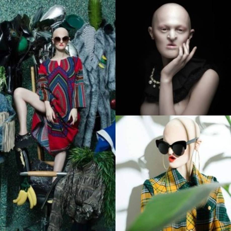 Melanie Gaydos: como dicen, cuando realmente quieres algo, absolutamente nada puede detenerte. Melanie Gaydos es un ejemplo perfecto de eso. A 26 años, la modelo estadounidense con un trastorno genético raro ha desafiado todas las probabilidades de convertirse en un modelo de moda de alta costura.<br/><br/>Su extraños rasgos la hacen ideal para fotografías de fantansia.<br/><br/>Su aspecto la ha dado la oportunidad de participar en clips de la banda alemana Rammstein.