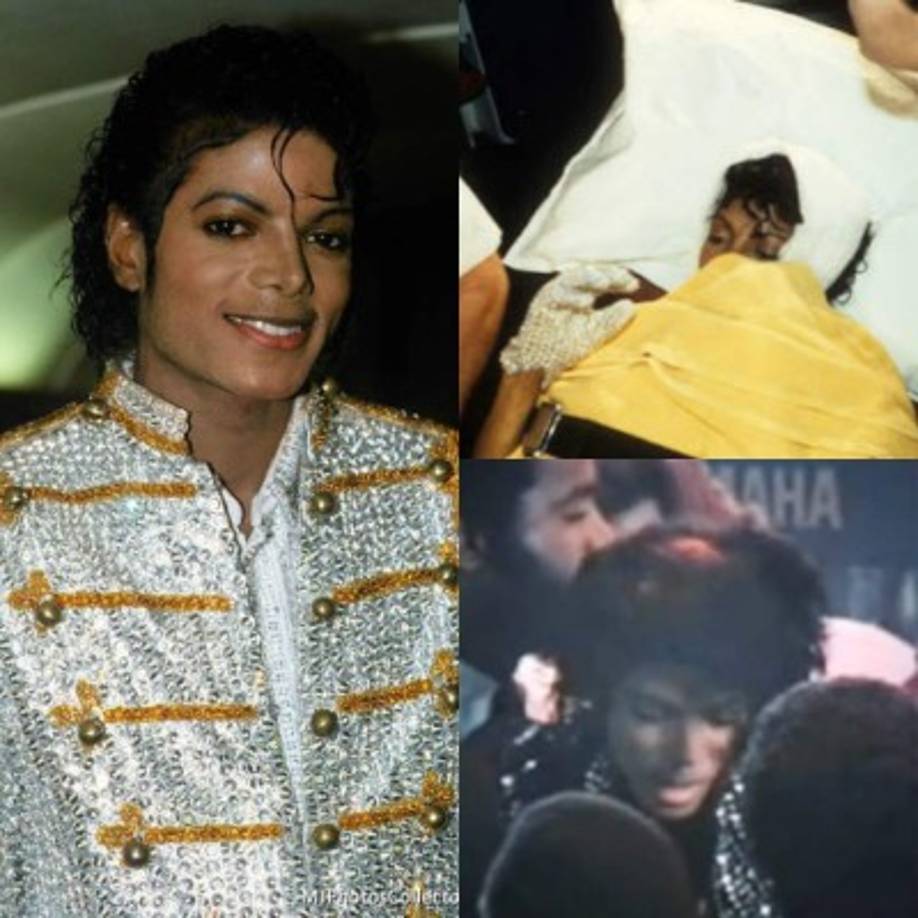 10- Accidente en comercial de Pepsi 1984: Durante el rodaje de un comercial para la bebida hubo un accidente que terminó rostizando su cabello. Se supone que unas juegos artificiales debían salir de la parte de atrás del escenario a sus espaldas, pero por desgracia el cabello del cantante se incendio y tuvieron que llevarlo a emergencias para curar las quemaduras.