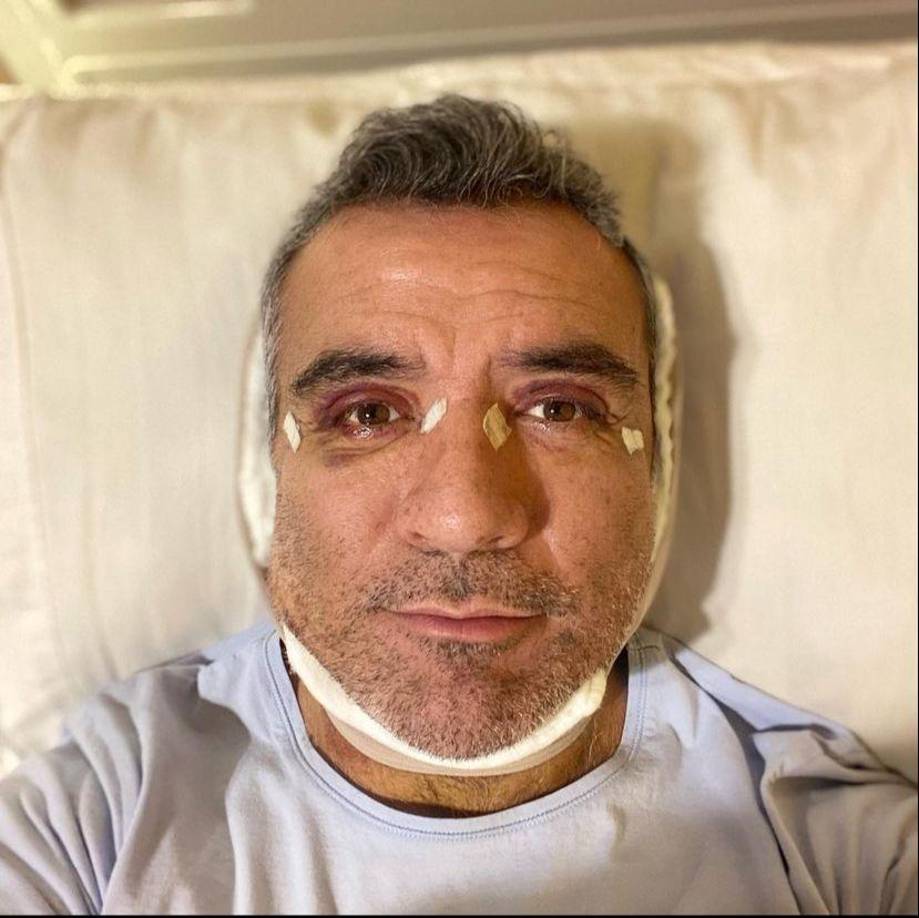 Sandarti contó que tenía en mente desde “hace mucho tiempo” darse “una ayudita” para verse “más fresco” y “un poquito más joven de la edad” que tiene.