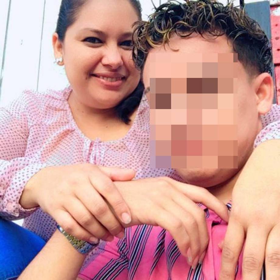 ”No fue ni duro el impacto, pegamos contra las llantas, a mí me fracturó la pierna y lamentablente mi hermana murió”.